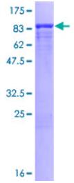 SDS-PAGE (FRS2-4506H).jpg